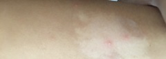 What are these spots?