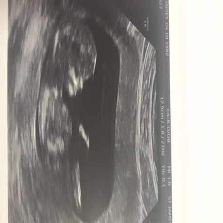 Pregnancies due March 2018