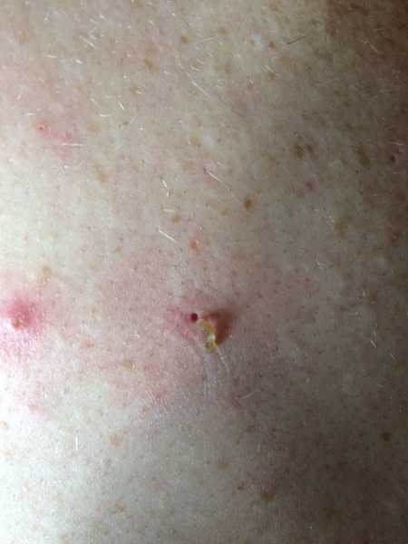 Look what I squeezed out of DP's back this morning