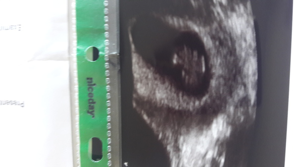 Pregnancies due March 2018