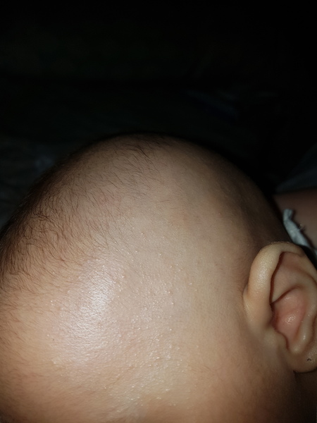 Baby has a rash! Pic inc
