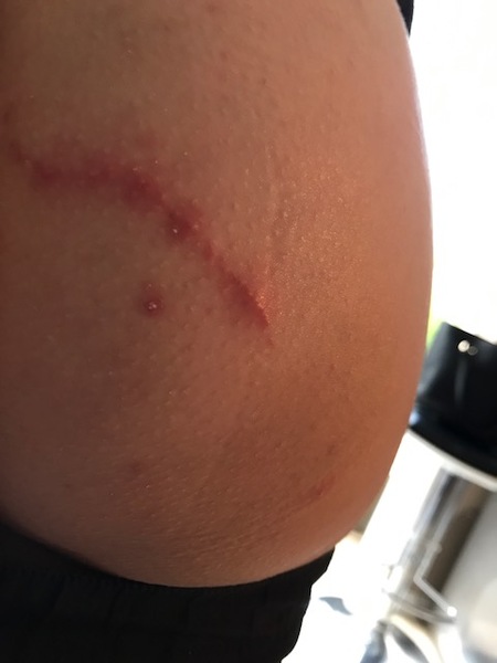 strange rash/spots any ideas please (picture included)