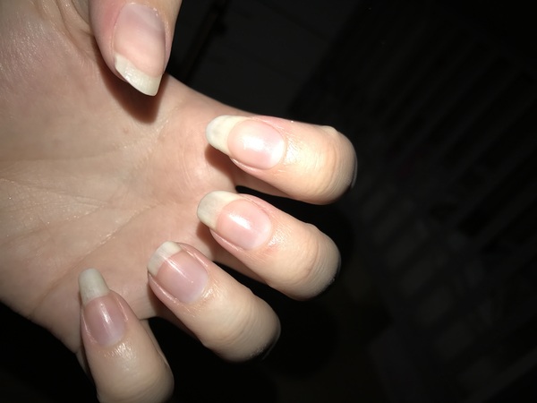 Can I see your nails?