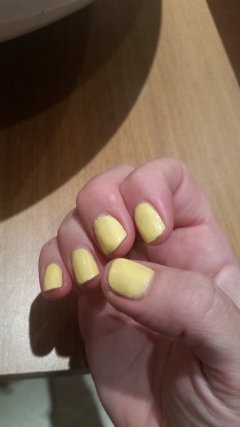 Can I see your nails?