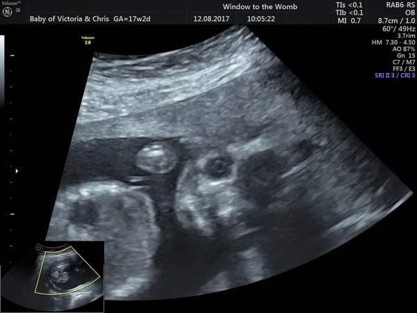 January Babies #4 - Blooming in to second trimester!