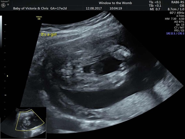 January Babies #4 - Blooming in to second trimester!