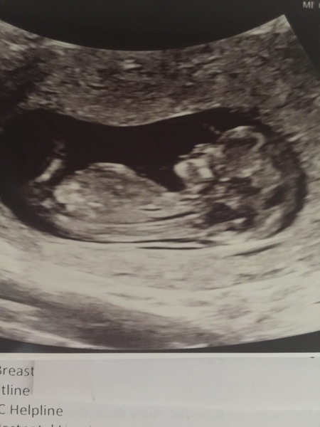 Any gender guesses please?