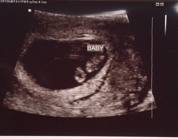 Babies due in April 2018