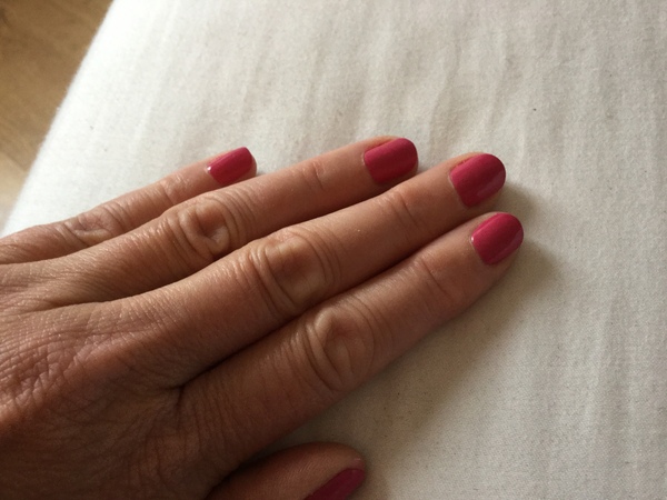 Can I see your nails?