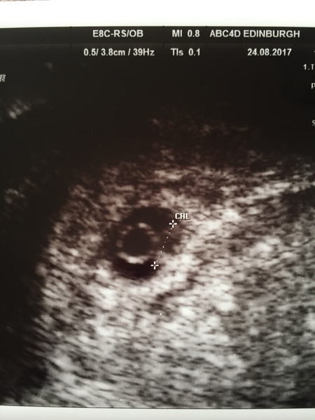 Babies due in April 2018