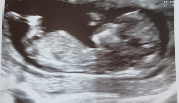 Boy or girl?