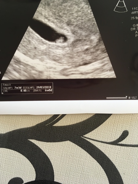 Pregnancies due March 2018