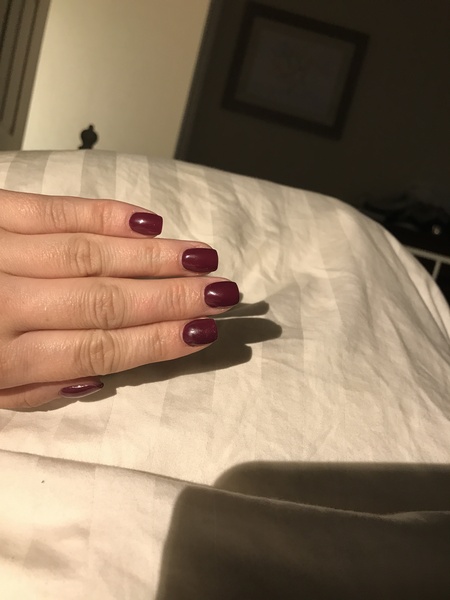 Can I see your nails?