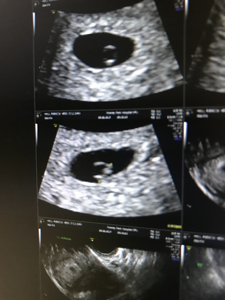 Babies due in April 2018