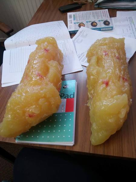 Blood sugar diet thread 7