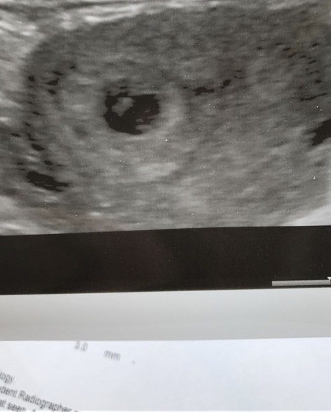 Nub pics help!!! (Gender)
