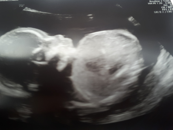 January Babies #4 - Blooming in to second trimester!