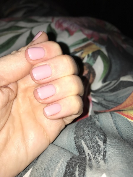 Can I see your nails?