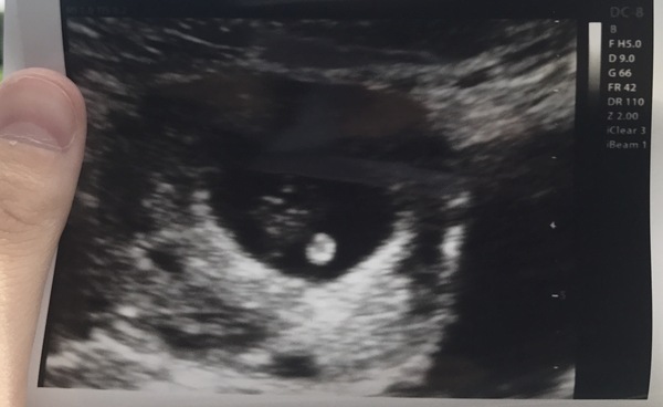 Babies due in April 2018