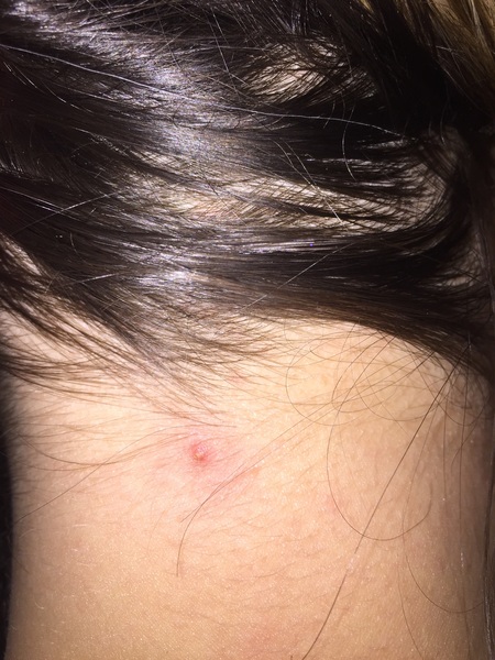 Should I LTB  (for refusing to squeeze)?