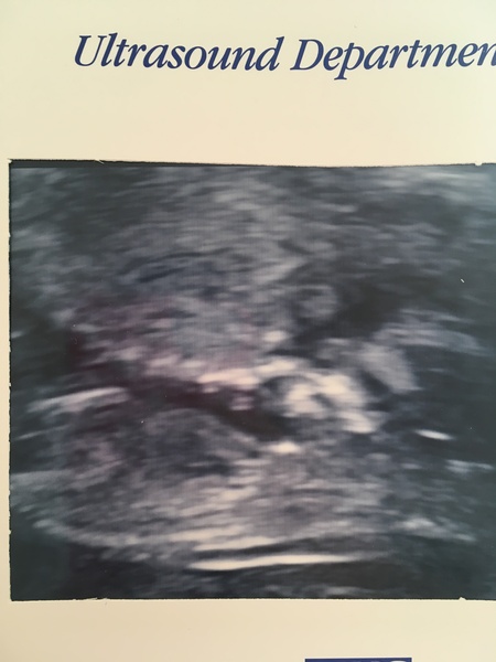 Gender Guesses!