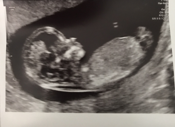 Boy or girl?