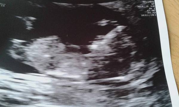 I'm pregnant!