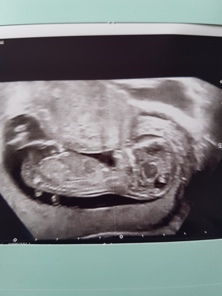 Part 2 - anyone found out they are pregnant and want some buddies