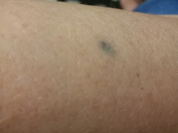 So this thing on my leg....