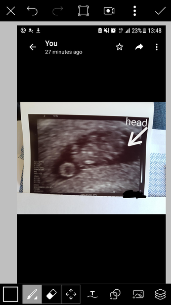 Pregnancies due March 2018