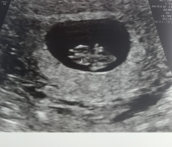 Babies due in April 2018