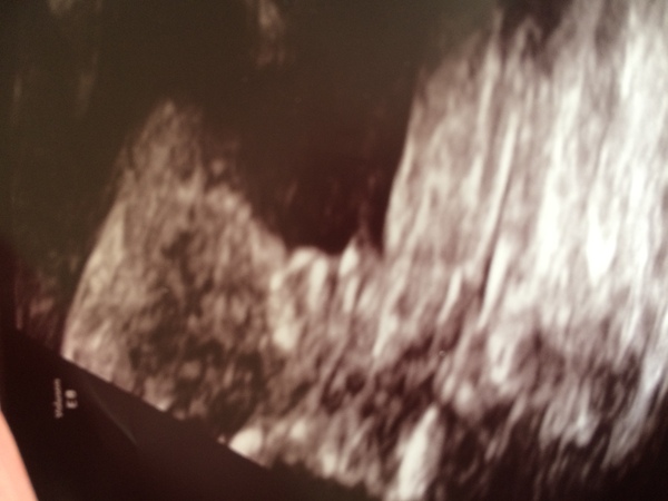 Boy or girl?!