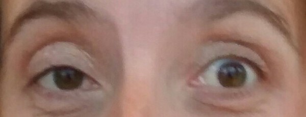 What can I do about my dodgy eyelids? Pic!