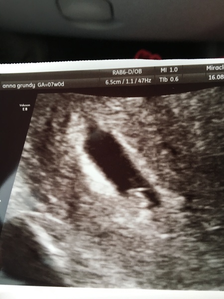 Babies due in April 2018