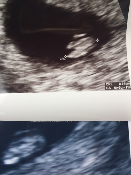 Babies due in April 2018