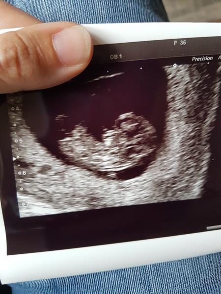 Anyone just found out they're preggers and want some buddies?