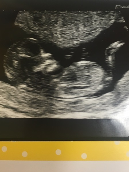 Anyone fancy a gender guess for me?