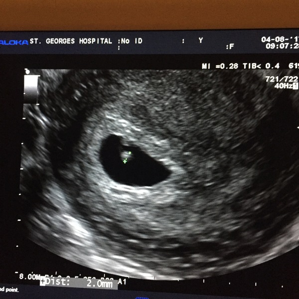 Babies due in April 2018