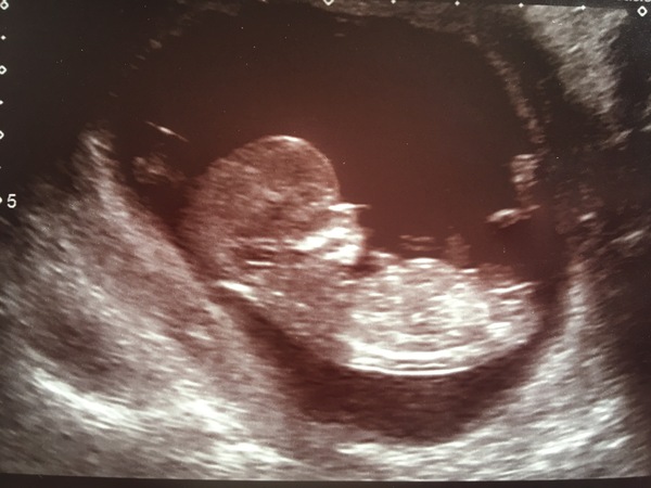 Gender Guesses!