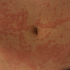 ARE THERE ANY GP'S ON HERE... PICS ATTACHED!