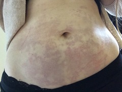 ARE THERE ANY GP'S ON HERE... PICS ATTACHED!