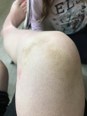 ARE THERE ANY GP'S ON HERE... PICS ATTACHED!