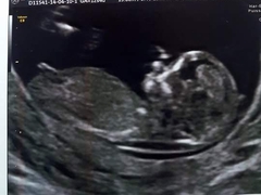 Nub pics help!!! (Gender)