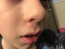 What are these bites/rashes/something???