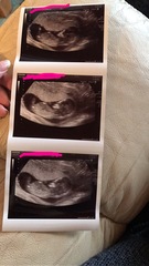 Boy or girl