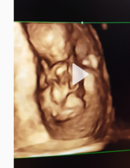 Nub pics help!!! (Gender)