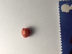 Would you like to see what I just got out of my arm?