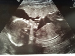 Gender predictions please?