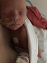 Hyperemesis Support