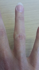 What is wrong with my knuckle (pic)?